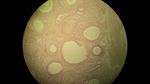 MISSING THUMBNAIL